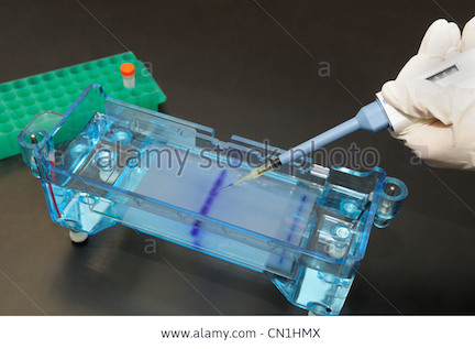 gel-electrophoresis-dna-samples-being-loaded-by-micropipet-into-the-CN1HMX